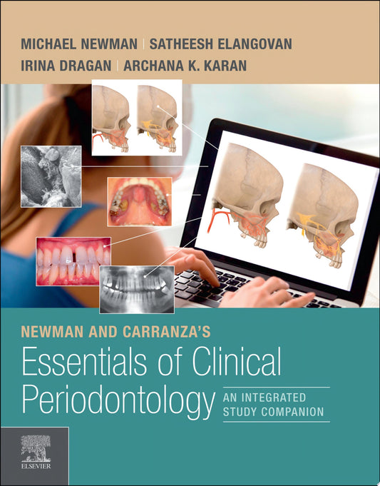 Newman and Carranza's Essentials of Clinical Periodontology E-Book