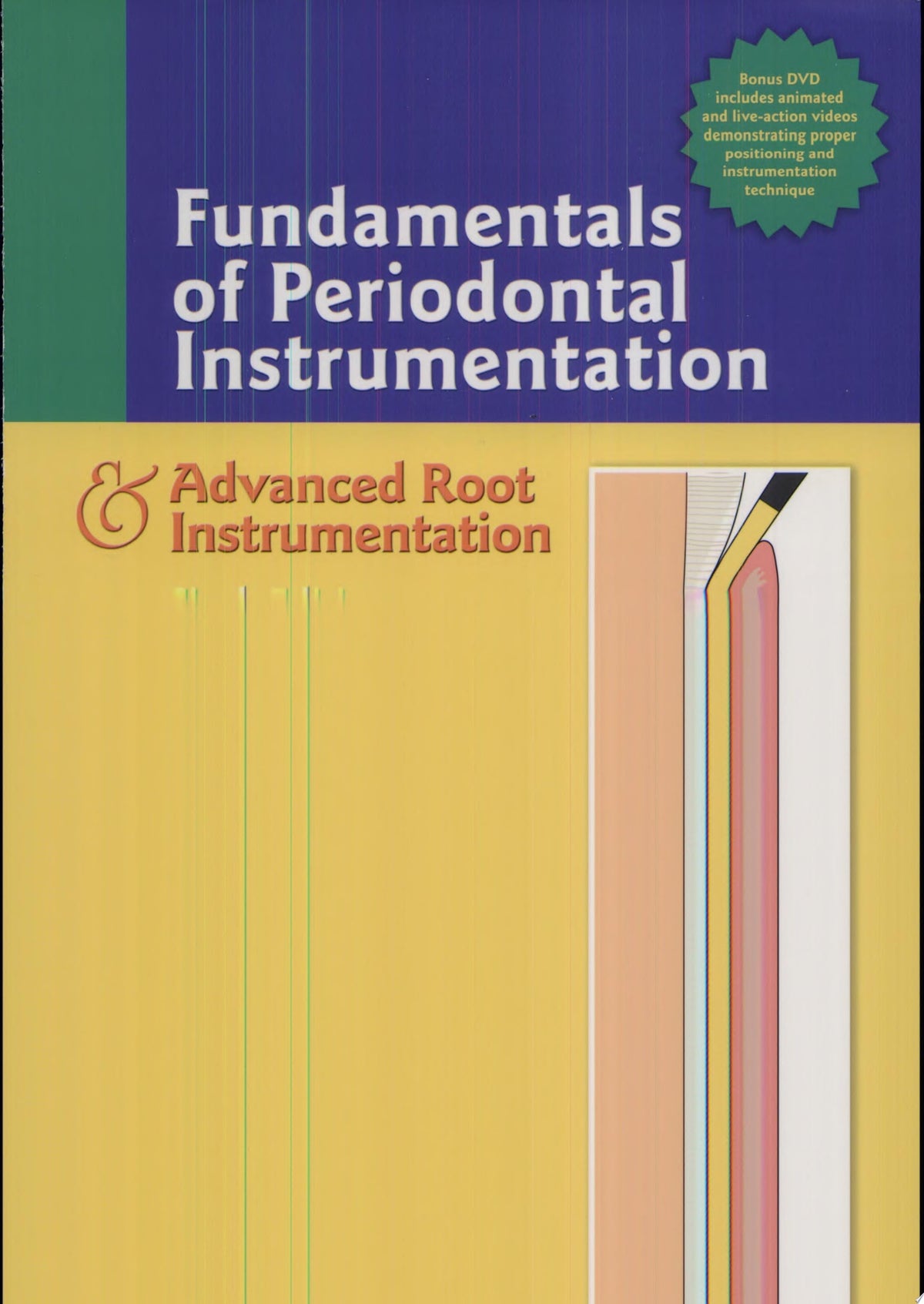 Fundamentals of Periodontal Instrumentation & Advanced Root Instrumentation