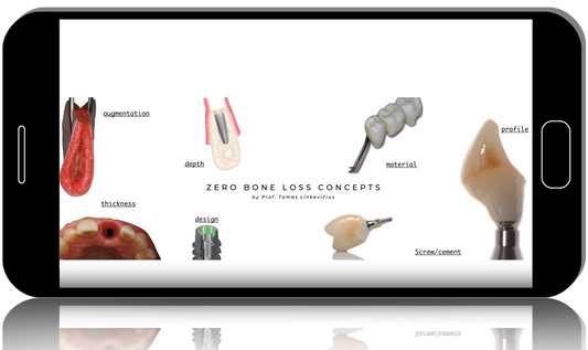 Zero Bone Loss Concepts - How to develop and maintain crestal bone stability
